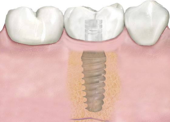 struct1 PS (1) Struct1 Ps (1)